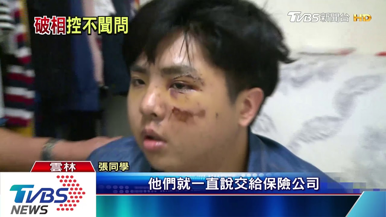 大四生應徵工作 半路遭轎車撞輾車底