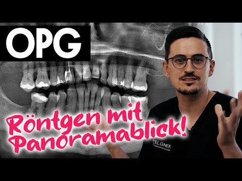 Panoramaschichtaufnahme / OPG - Röntgenbild mit Panoramafunktion