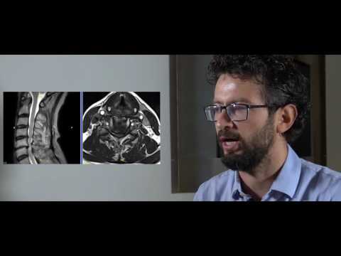 Malattia comune negli anziani e trattamento Trattamento delle articolazioni delle gambe delle dita dei piedi