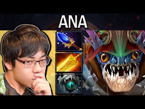 Slark Dota 2 Gameplay Ana with Radiance and 27 Kills