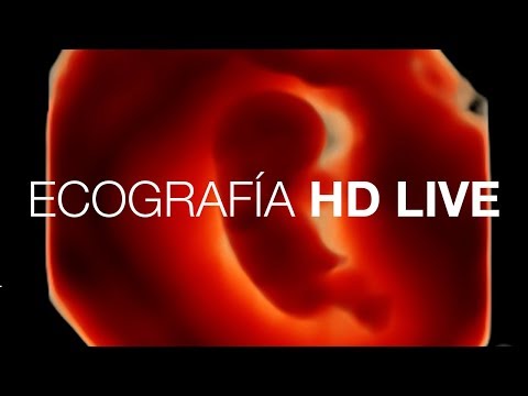 ECOGRAFÍA HD LIVE