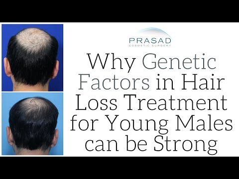 Why Strong Genetic DHT-Sensitivity in Young Men is a Major Challenge of Hair Loss Treatment