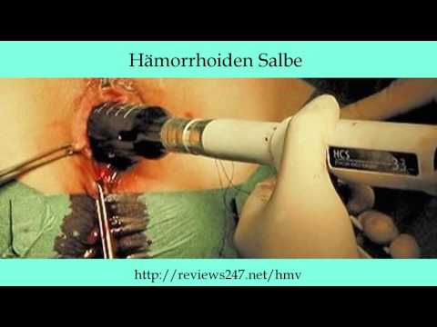 Die Schuppenflechte der Nägel das Symptom des Fingerhutes Das langdauernde Ekzem des Handgelenks