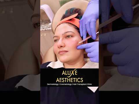 Nose Filler Transformation
