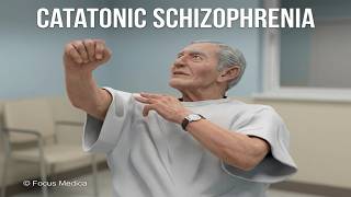 Catatonic Schizophrenia