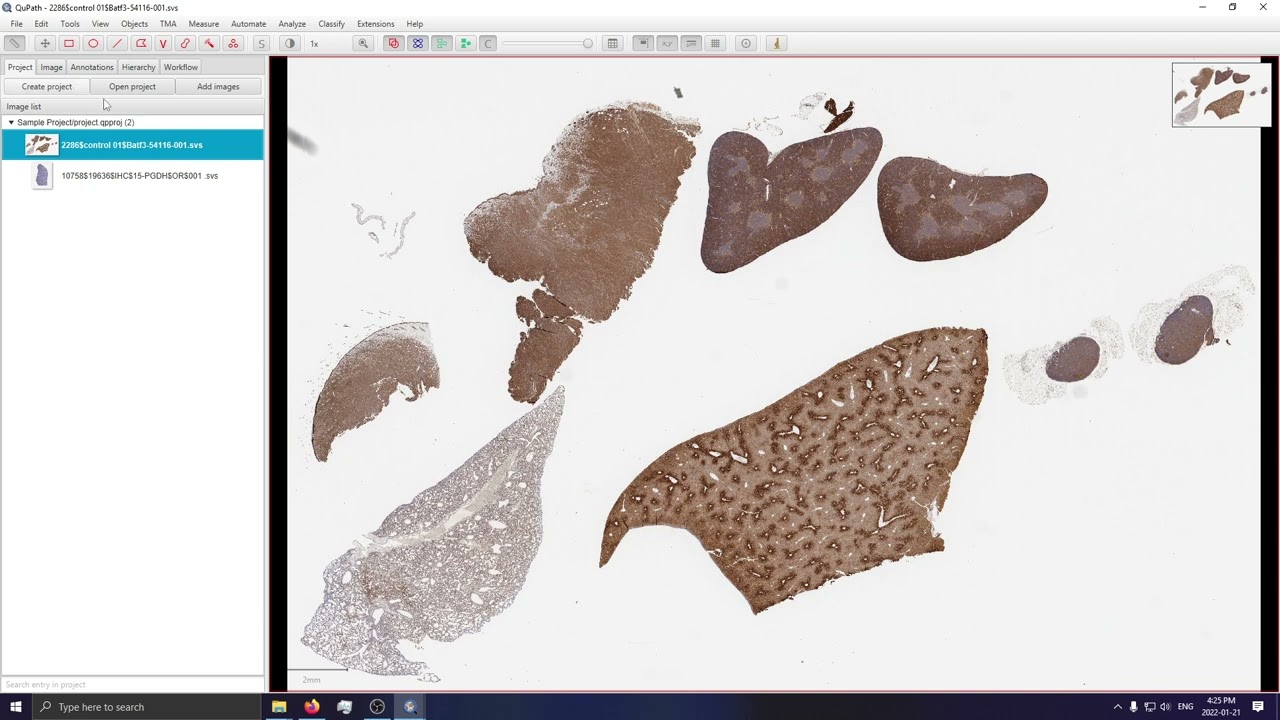 Image Viewing with QuPath