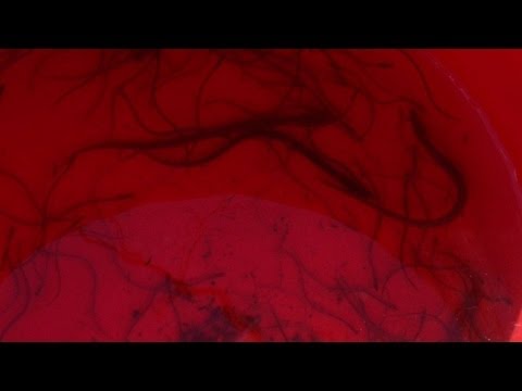 Schlüpfrig, lecker und in Gefahr: Aale