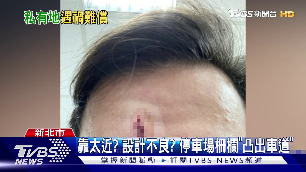 私人停車場政府「無法管」! 車損人傷「先蒐證」