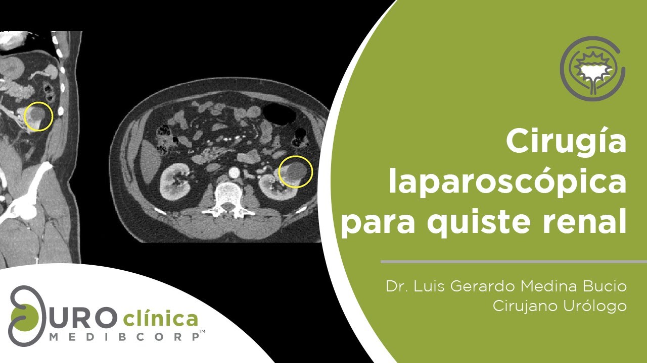 Luis Gerardo Medina Bucio-32