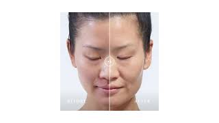 CARE Plastic Surgery | DG_Before-After-01