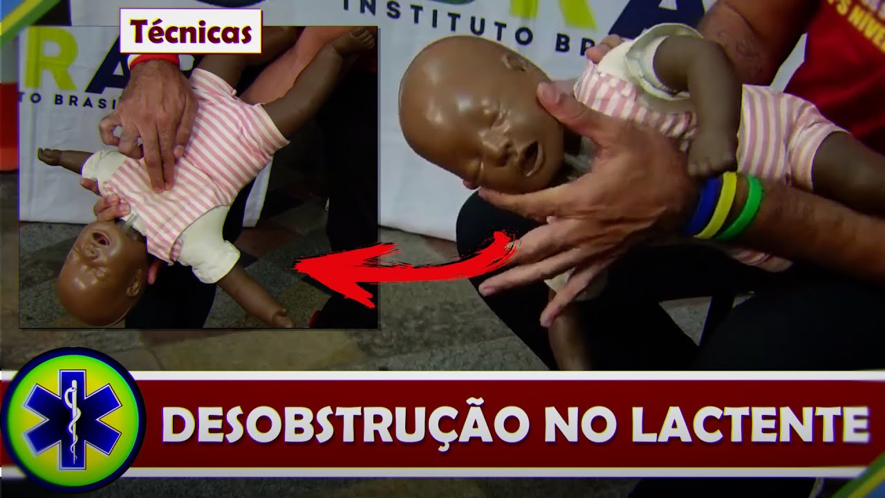 Faça isso para salvar um BEBÊ ENGASGASO | Técnicas de SBV e Primeiros Socorros