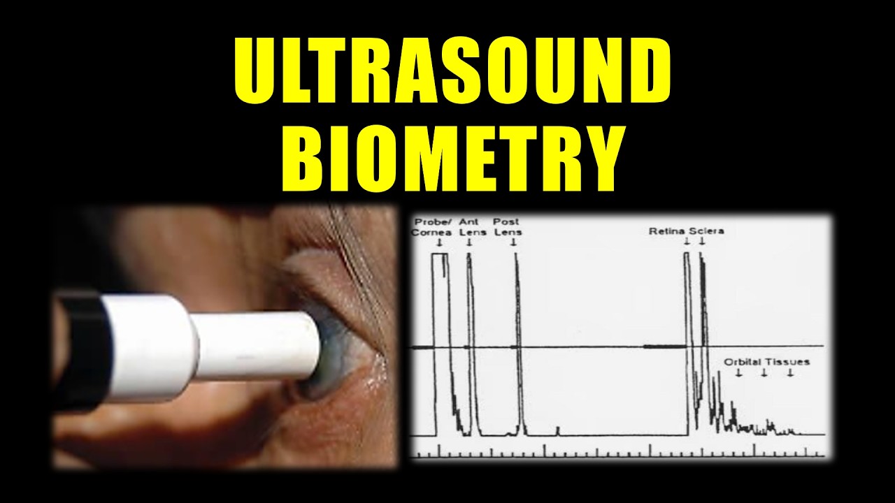 A SCAN BIOMETRY | Principles, contact and immersion biometry |