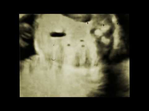 Video thumbnail for Innocent Until Birth