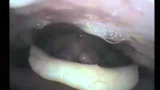 Healthy young female opera singer