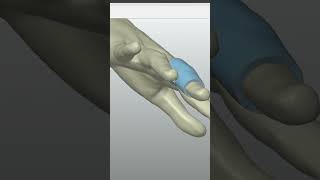 Download lagu QUICKSURFACE's Medical Uses #cad #3dreverseengineering mp3 Download lagu QUICKSURFACE's Medical Uses #cad #3dreverseengineering mp3