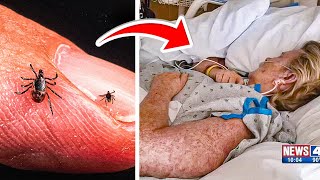 Mom Passes Away After Brushing Off 'Normal' Bug Bites