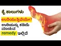 ಈ ರೀತಿ ಮನೆಮದ್ದು ಮಾಡಿದರೆ ಕೈ ಕಾಲು ಉರಿ ನಿ