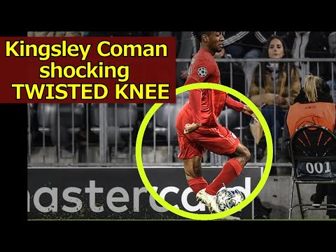 Bayern Kingsley Coman - terrible Knee POP injury