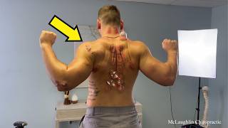Muscle Man Gets *CRACKED* After Accident Leaves Him Scarred & Injured - Dr. Ed 💪