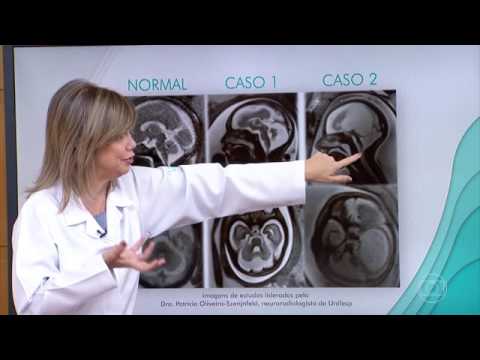 Zika vírus um ano depois, Parte 1