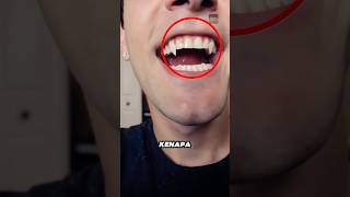 Download lagu Kenapa ada orang yang memiliki gigi vampir😱 mp3 Download lagu Kenapa ada orang yang memiliki gigi vampir😱 mp3