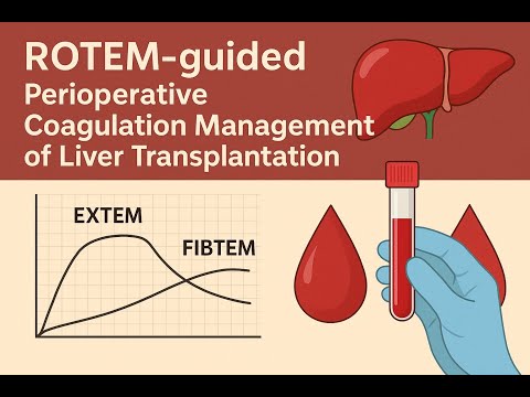02🩸 ROTEM-guided Perioperative Coagulation Management of Liver Transplantation ✨