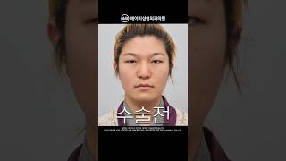 [MAKE ME Girl] ※놀람주의※ 역대급 성형 전후 | 맥미걸 #shorts