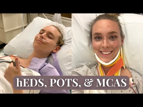 How Ehlers Danlos Syndrome Affects My Life