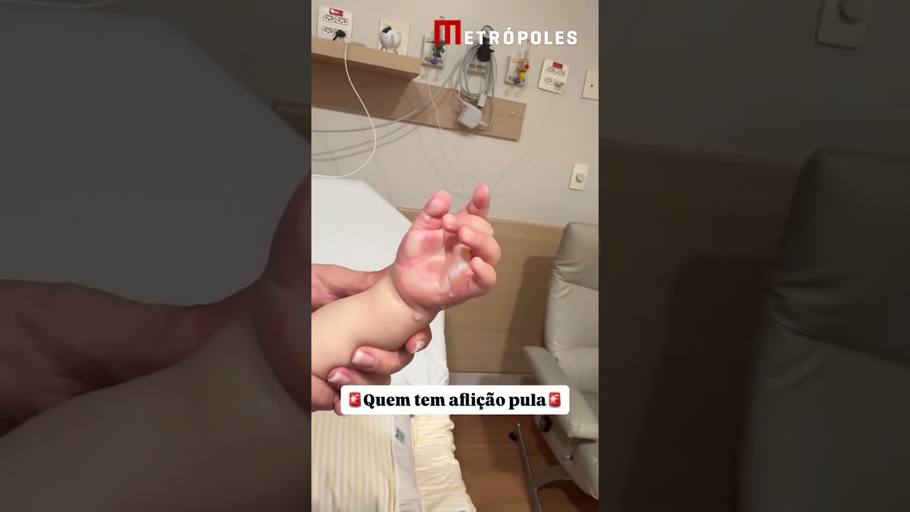 Imagens fortes: caçula de Viih Tube sofre queimadura e é internado XX 1