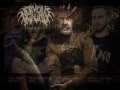 Technical Brutal Death Metal Bands New Releases 2015