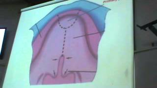 Embryology Dr. Sherif Fahmy 7 - face and tounge