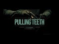 Pulling Teeth