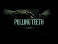Pulling Teeth