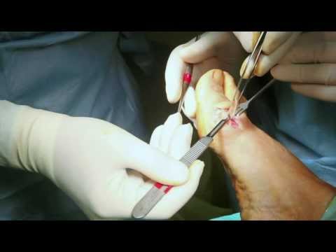 Fitball di osteocondrosi Perché il mal di schiena, se non ha colpito