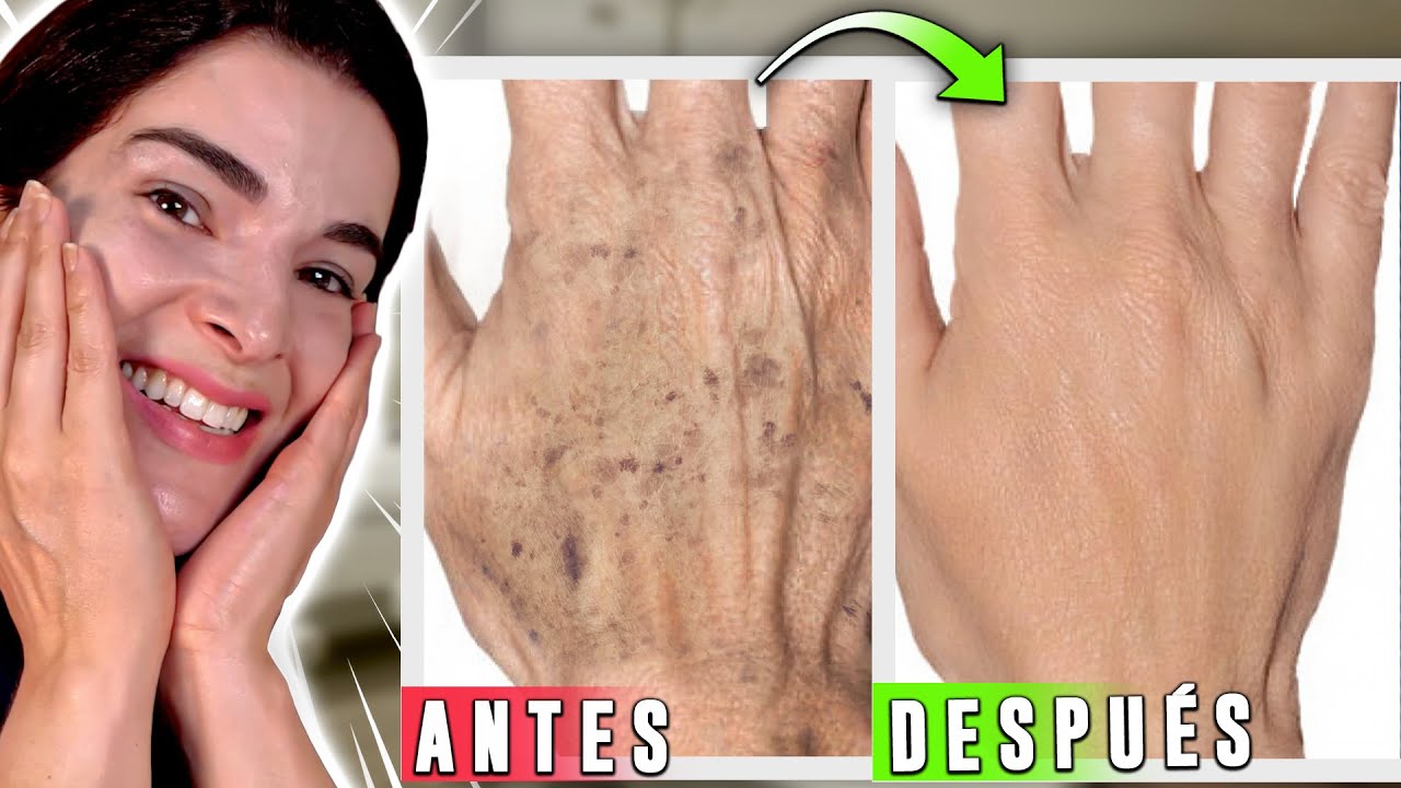 ¡Lo Mejor para MANOS SECAS con ARRUGAS y MANCHAS!