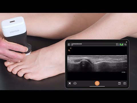 How to Scan Small Joints: Ultrasound Scanning Technique