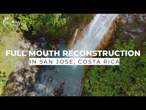 Full Mouth Restoration in San Jose, Costa Rica