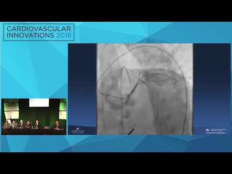 CVI2018 Session: My Best Case of the Year - Manish Parikh, MD