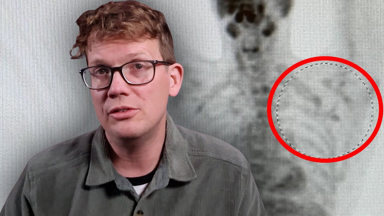 I Still Don't Have Cancer (and I'm Still Scared)