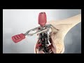 Attune Primary FB Surgical Technique Animation