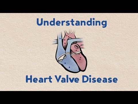 Understanding Heart Valve Disease