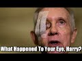 What Happened To Your Eye Harry The Refinery 3 31 15 SNIP