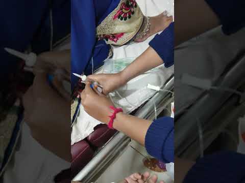 Iron Sucrose Injection