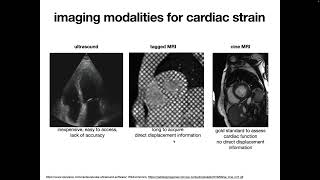 Francisco Sahli - WarpPINN: Cine-MR image registration with physics-informed neural networks