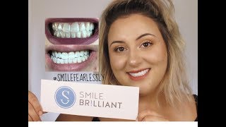 How I Whiten My Teeth At Home + GIVEAWAY | Ashley Chadwick