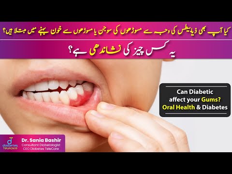 Swollen Gums & Diabetes- Bad Breath- Dry Mouth-Tooth infection Oral Health & Diabetes in Urdu Part 1