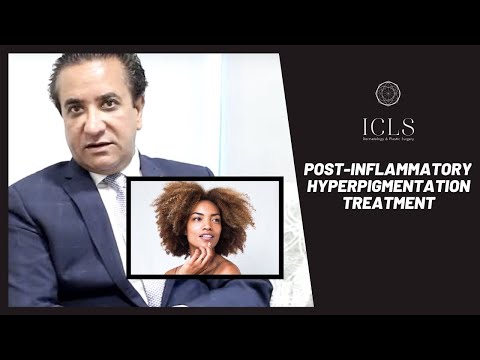 How to Treat Post Inflammatory Hyperpigmentation | Dermatology | ICLS Dermatology & Plastic Surgery