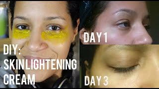 DIY: Natural Skin Lightening Cream to Get Rid of Dark Circles