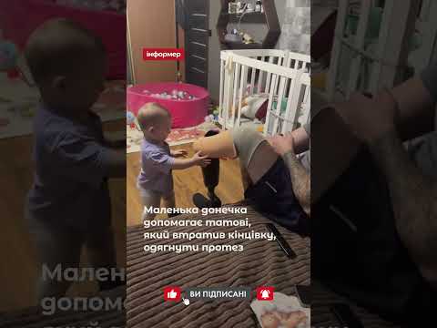 Маленька донечка допомагає татові одягнути протез.