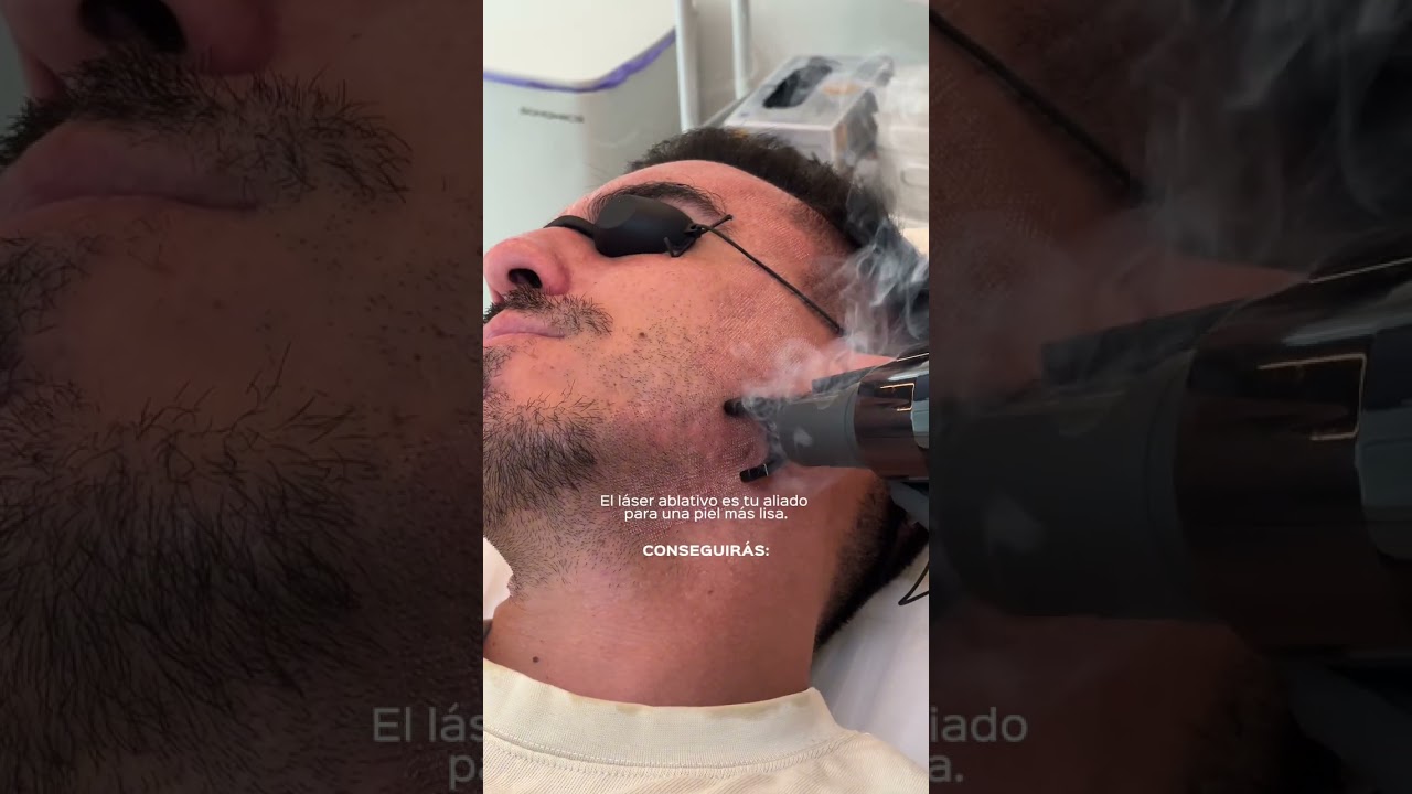 Santé Clínica Estética Barcelona